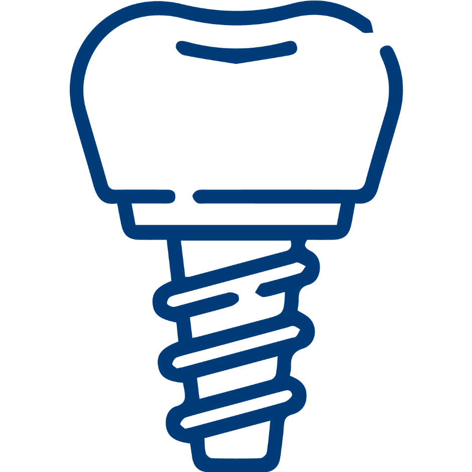 Dental Implants